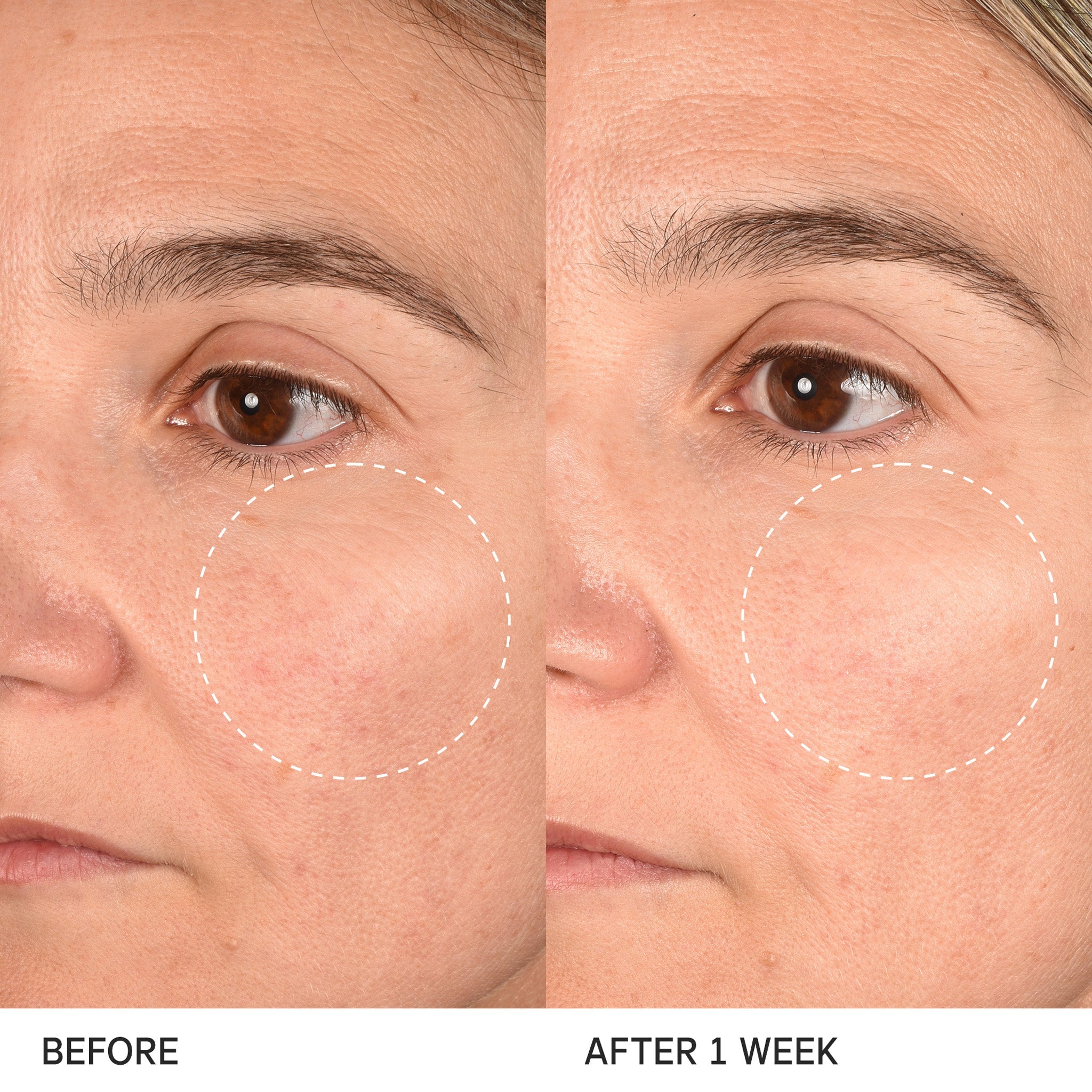 THE LONGEVITY MEMORY CREAM