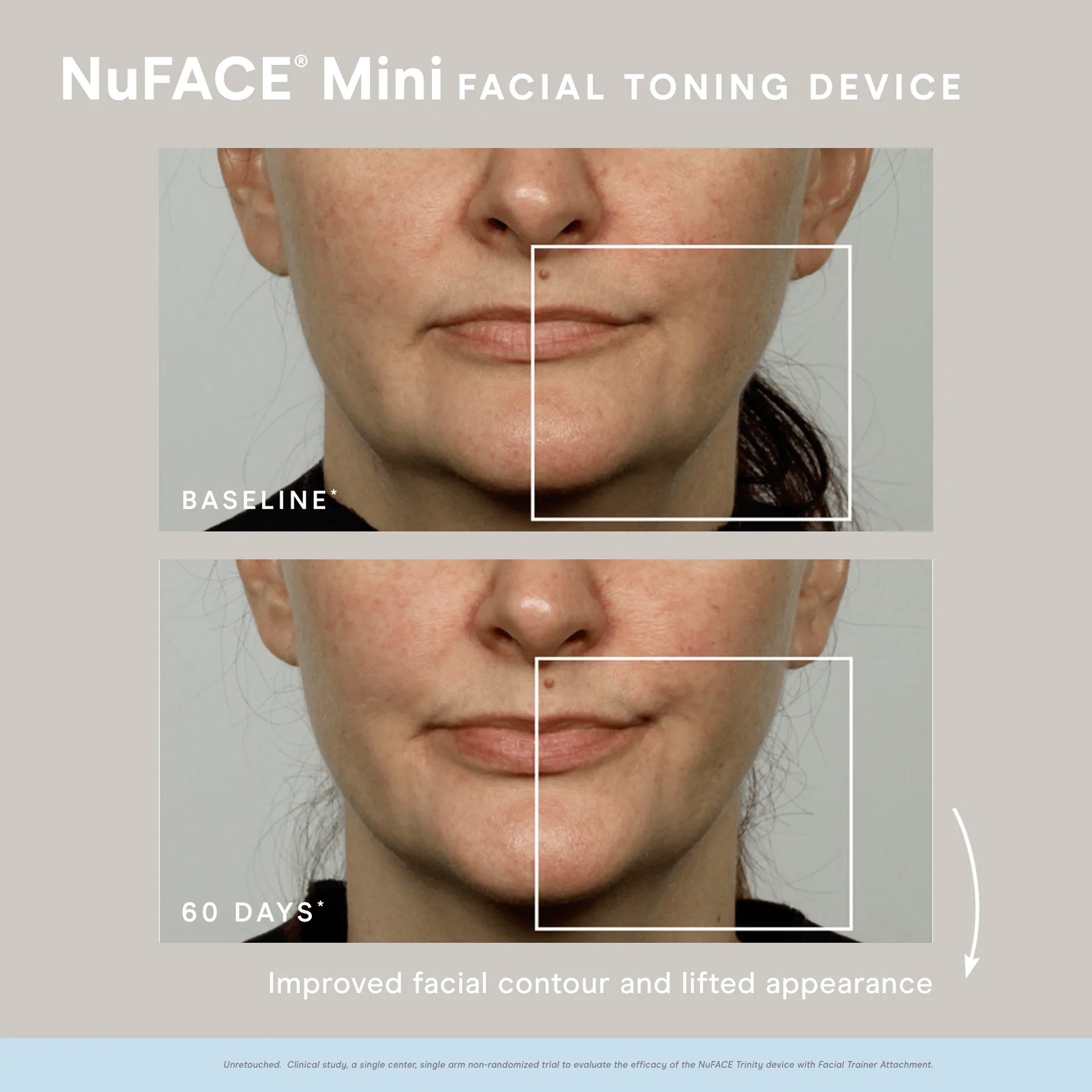 Deals Nuface mini